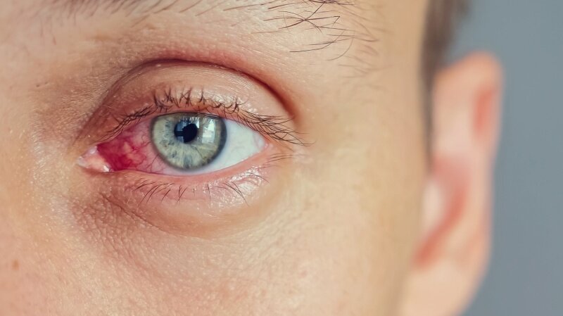 Диабет глаза: симптомы и профилактика