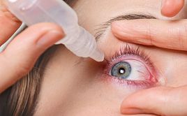 Виды глазной аллергии
